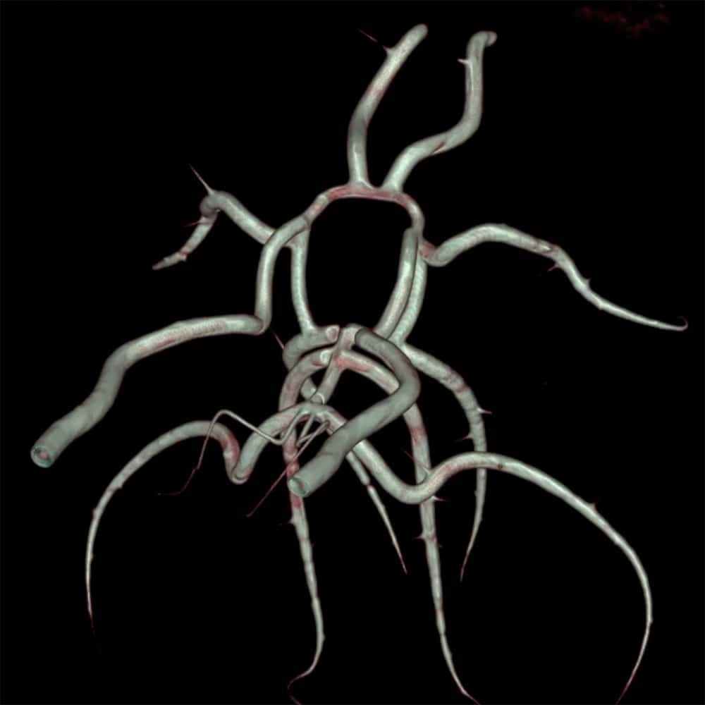 Circle of Willis 3D medical phantom visualization